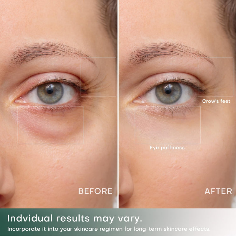 Tighten & Smooth Belly Cream